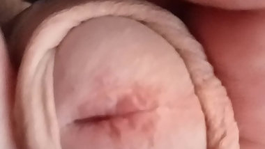 Peeling